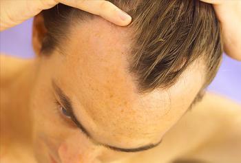 Спрей от выпадения волос косилон