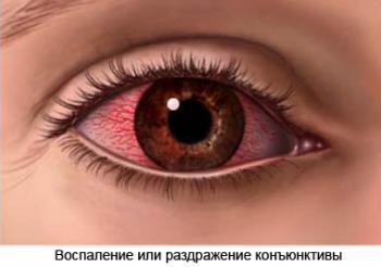 Капли от синдрома сухого глаза оксиал
