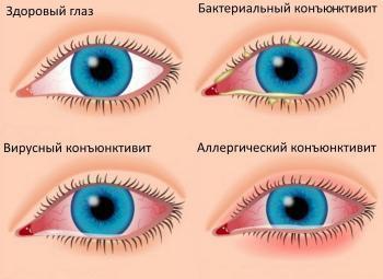 Глазные капли синие от аллергии