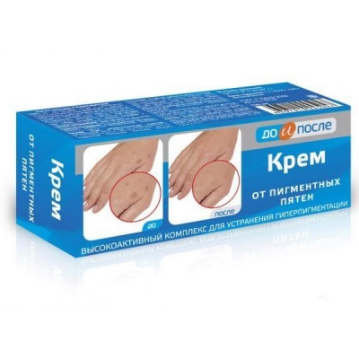 До и после Крем против пигментных пятен 50 мл