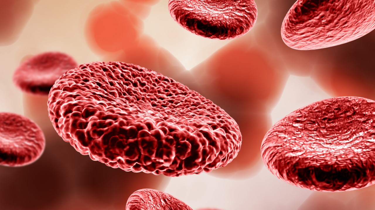 Железодефицитная анемия: причины и симптомы нехватки железа в организме