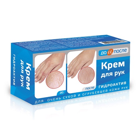 До и после Крем для рук гидроактив 100 мл