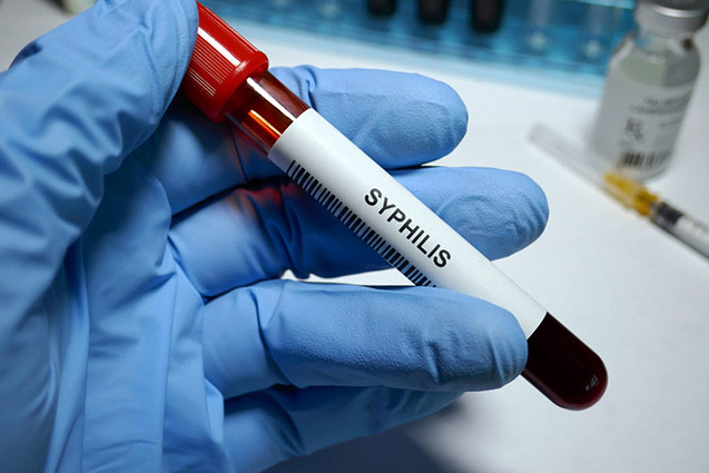 Сифилис: симптомы и лечение