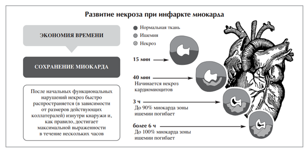 Инфаркт и секс - причины, симптомы, диагностика, лечение и профилактика