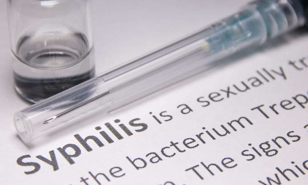 Течение сифилиса