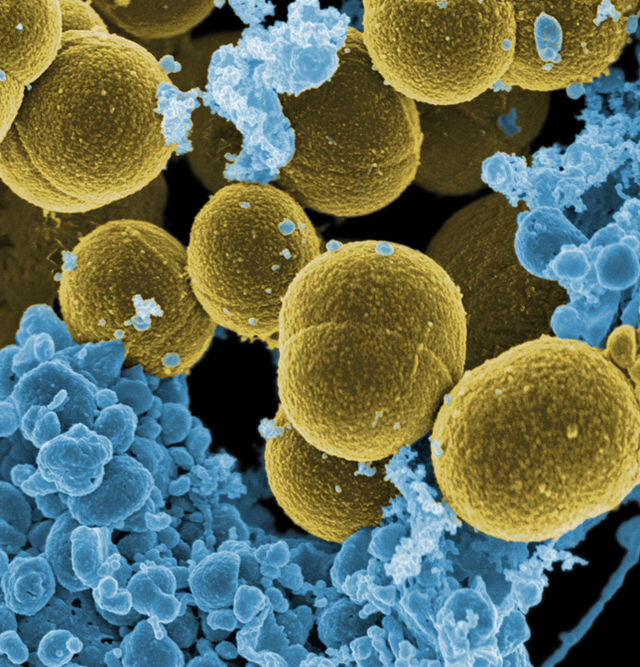 Найдено мощное оружие против устойчивого к антибиотикам стафилококка